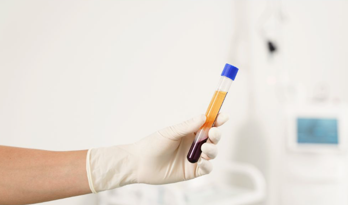 A vérplazma adás fontossága és előnyei