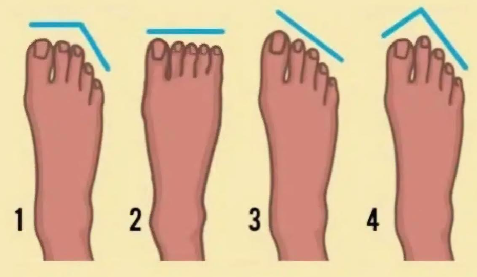 Milyen a lábfejed formája? Ez leleplezi az igazi énedet