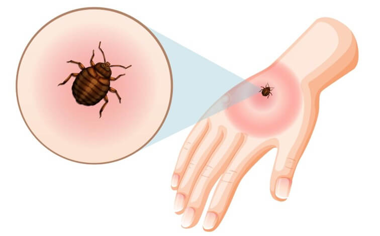 Kullancscsípésből halálos allergia: új kutatási eredmények